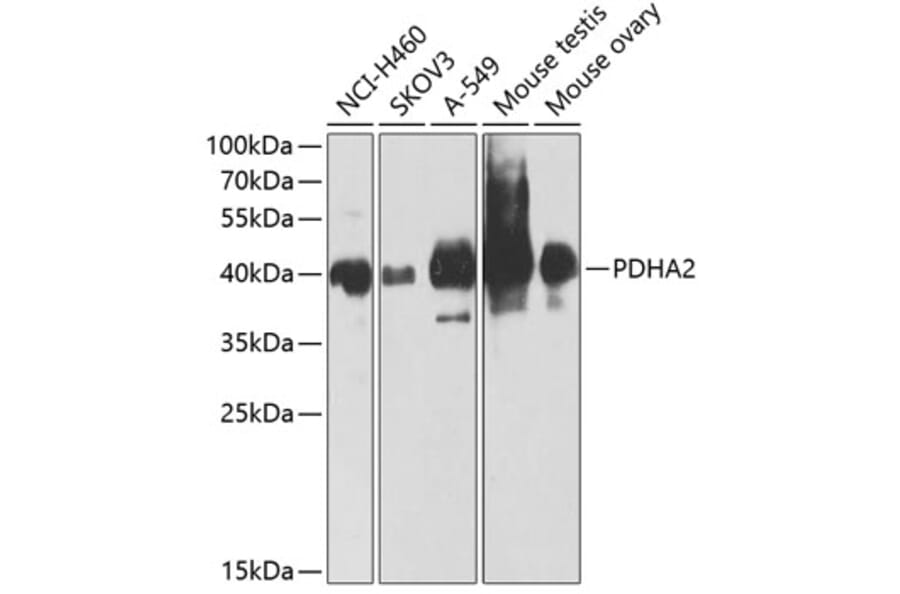Western Blot - Anti-PDHA2 Antibody (A12424) - Antibodies.com