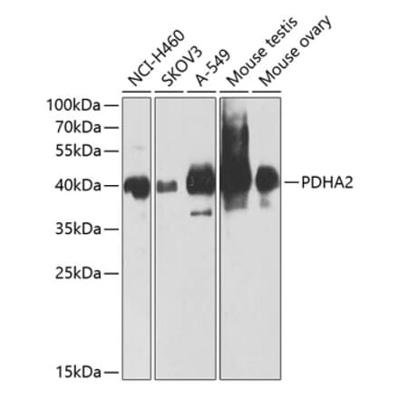 Western Blot - Anti-PDHA2 Antibody (A12424) - Antibodies.com