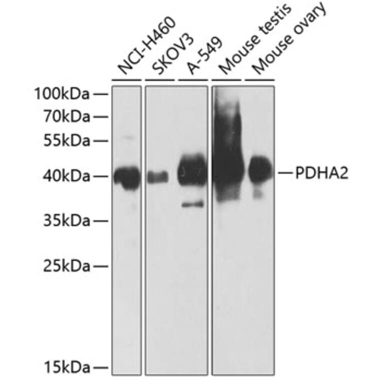 Western Blot - Anti-PDHA2 Antibody (A12424) - Antibodies.com