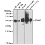 Western Blot - Anti-PDHA2 Antibody (A12424) - Antibodies.com