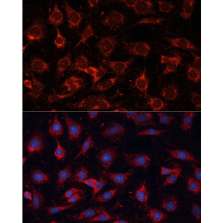 Immunofluorescence - Anti-PDHA2 Antibody (A12424) - Antibodies.com