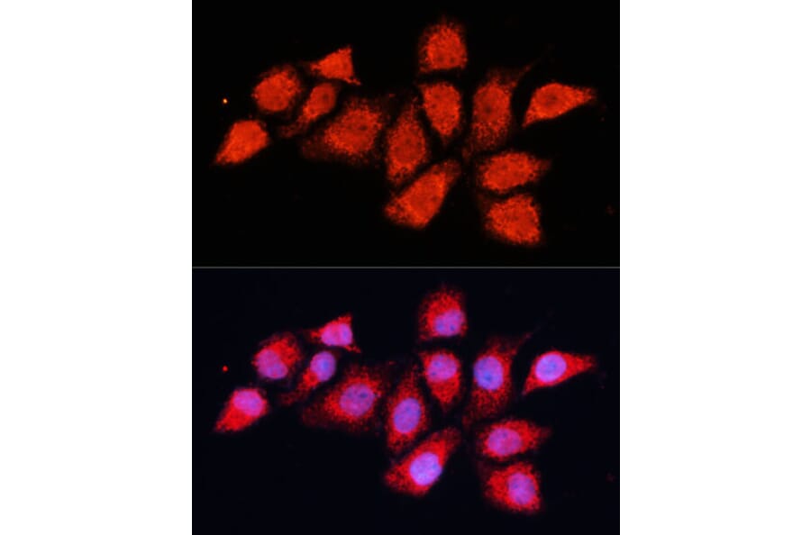 Immunofluorescence - Anti-PDHA2 Antibody (A12424) - Antibodies.com