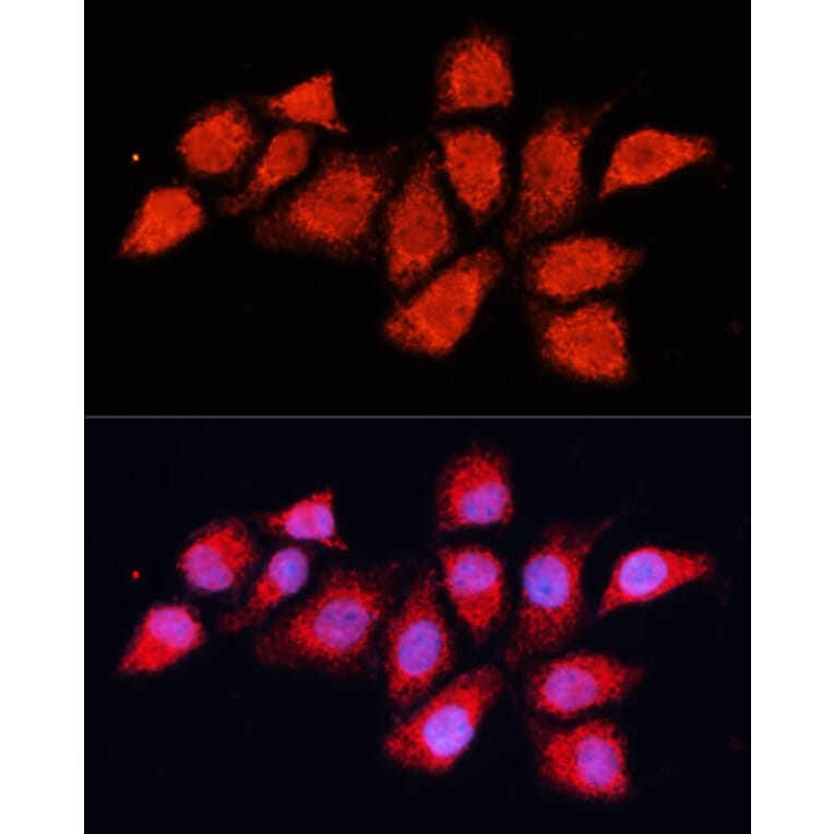Immunofluorescence - Anti-PDHA2 Antibody (A12424) - Antibodies.com