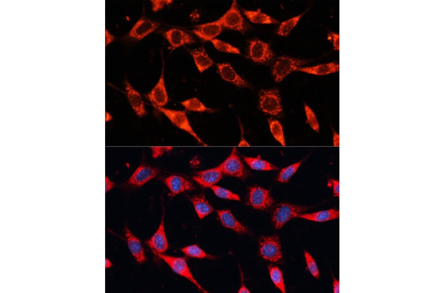 Immunofluorescence - Anti-PDHA2 Antibody (A12424) - Antibodies.com