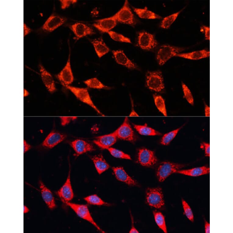 Immunofluorescence - Anti-PDHA2 Antibody (A12424) - Antibodies.com