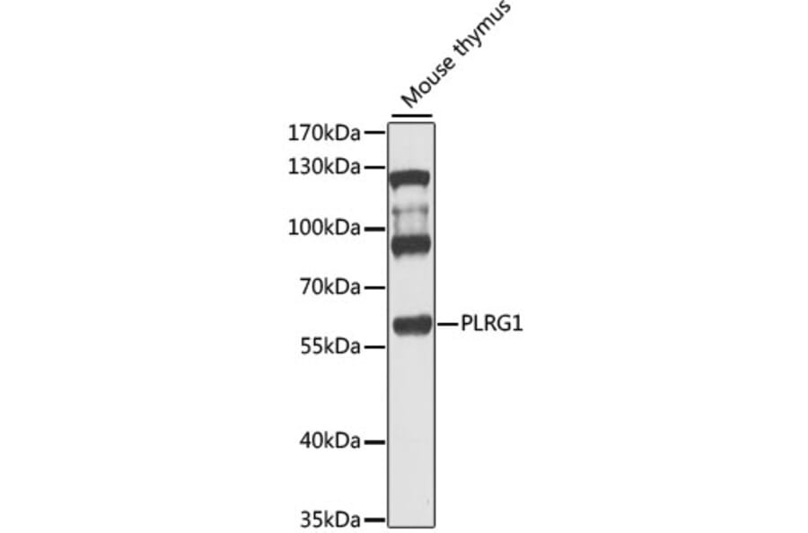 Western Blot - Anti-PLRG1 Antibody (A9946) - Antibodies.com