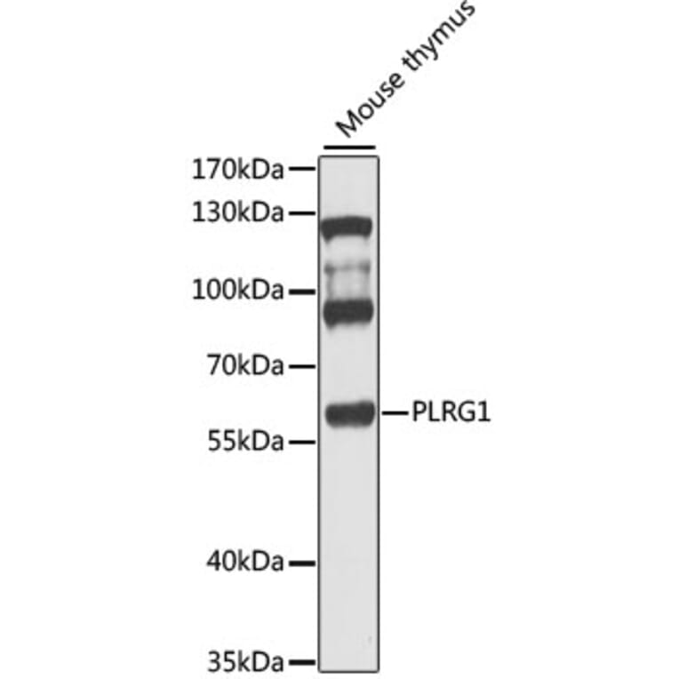 Western Blot - Anti-PLRG1 Antibody (A9946) - Antibodies.com