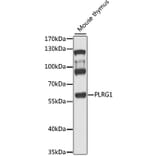 Western Blot - Anti-PLRG1 Antibody (A9946) - Antibodies.com
