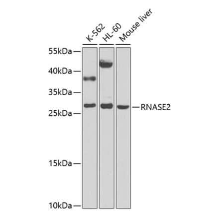 Western Blot - Anti-Eosinophil derived neurotoxin Antibody (A12426) - Antibodies.com