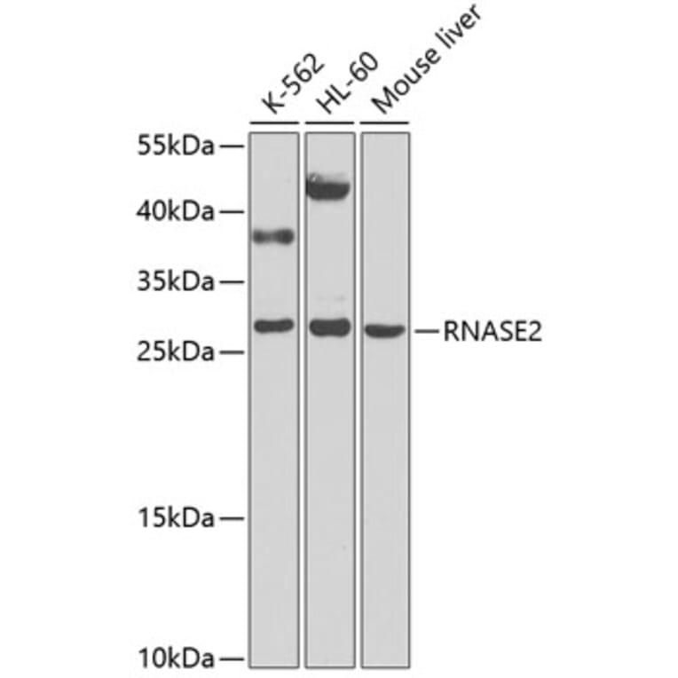 Western Blot - Anti-Eosinophil derived neurotoxin Antibody (A12426) - Antibodies.com