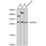 Western Blot - Anti-Eosinophil derived neurotoxin Antibody (A12426) - Antibodies.com