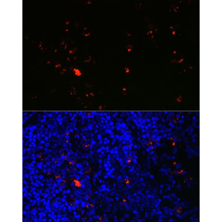 Immunofluorescence - Anti-Eosinophil derived neurotoxin Antibody (A12426) - Antibodies.com