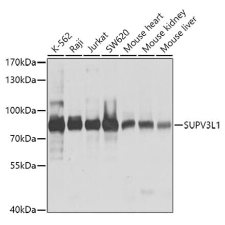 Western Blot - Anti-SUV3L1 Antibody (A12427) - Antibodies.com