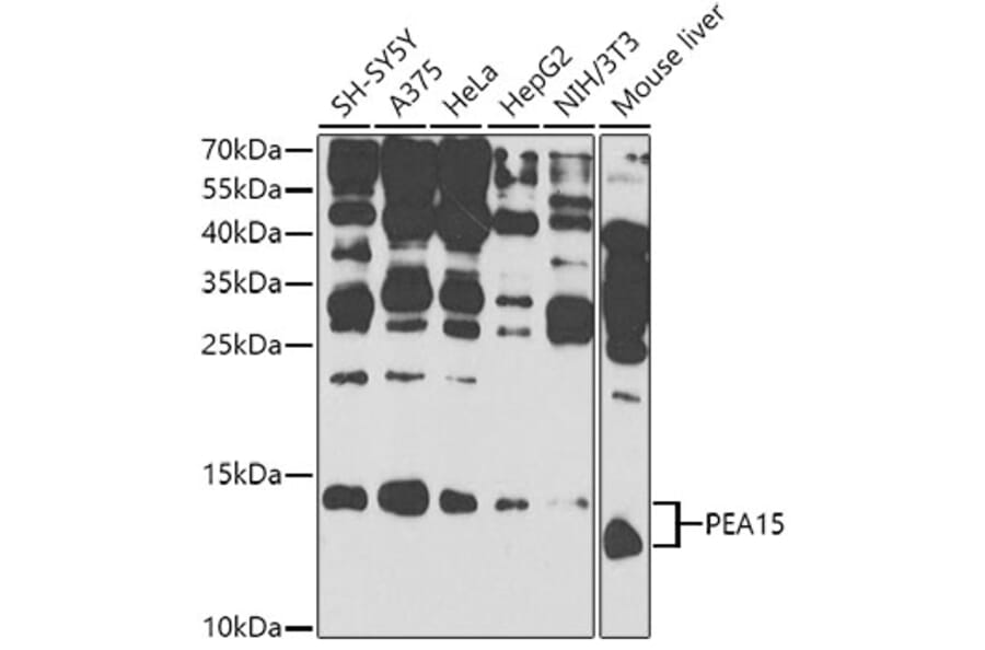 Western Blot - Anti-PEA15 Antibody (A12429) - Antibodies.com