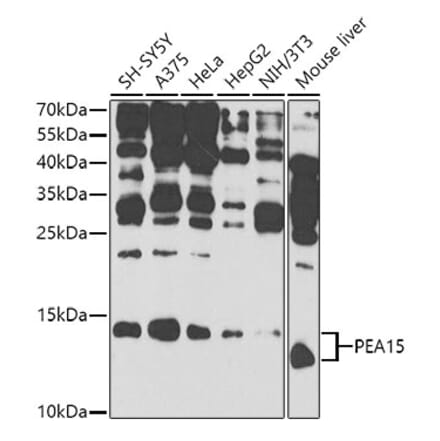 Western Blot - Anti-PEA15 Antibody (A12429) - Antibodies.com
