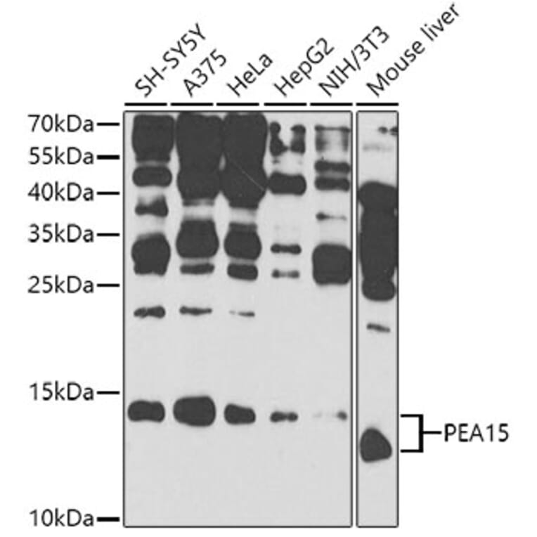 Western Blot - Anti-PEA15 Antibody (A12429) - Antibodies.com