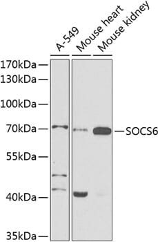 Western blot analysis of extracts of various cell lines, using Anti-SOCS6 Antibody (A9957) at 1:1,000 dilution.
Secondary antibody: Goat Anti-Rabbit IgG (H+L) (HRP) (AS014) at 1:10,000 dilution.
Lysates / proteins: 25µg per lane.
Blocking buffer: 3% non-fat dry milk in TBST.
Detection: ECL Basic Kit (RM00020).
Exposure time: 30s.