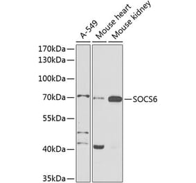 Western Blot - Anti-SOCS6 Antibody (A12430) - Antibodies.com