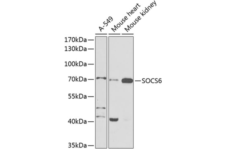 Western Blot - Anti-SOCS6 Antibody (A12430) - Antibodies.com