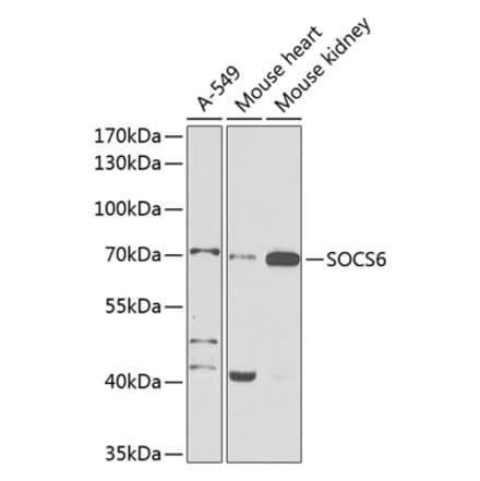 Western Blot - Anti-SOCS6 Antibody (A12430) - Antibodies.com