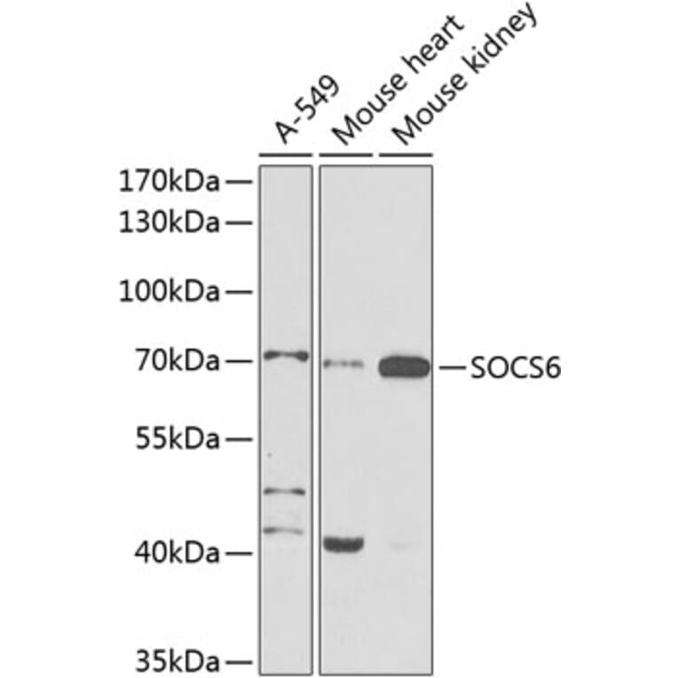 Western Blot - Anti-SOCS6 Antibody (A12430) - Antibodies.com