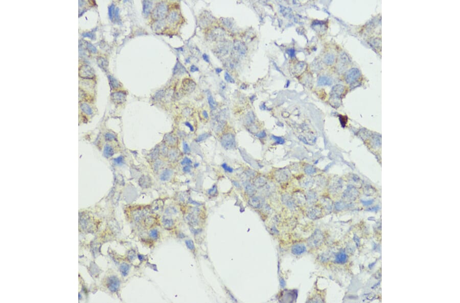 Immunohistochemistry - Anti-SOCS6 Antibody (A12430) - Antibodies.com