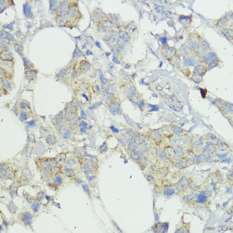 Immunohistochemistry - Anti-SOCS6 Antibody (A12430) - Antibodies.com