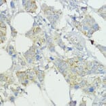 Immunohistochemistry - Anti-SOCS6 Antibody (A12430) - Antibodies.com