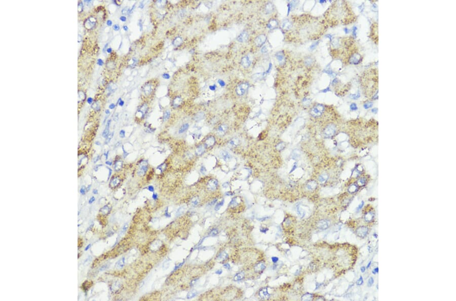 Immunohistochemistry - Anti-SOCS6 Antibody (A12430) - Antibodies.com