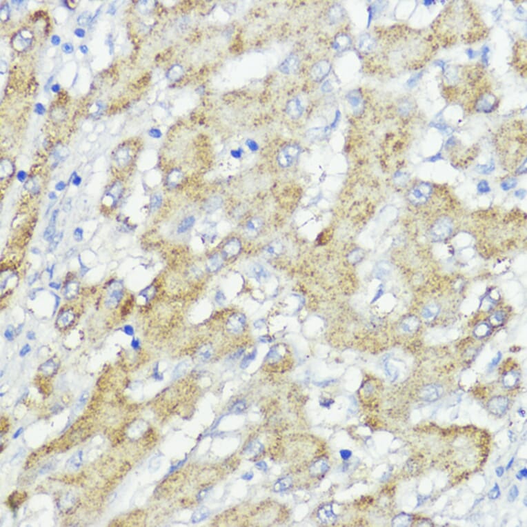 Immunohistochemistry - Anti-SOCS6 Antibody (A12430) - Antibodies.com