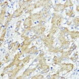 Immunohistochemistry - Anti-SOCS6 Antibody (A12430) - Antibodies.com