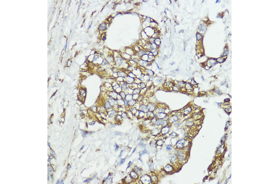 Immunohistochemistry - Anti-SOCS6 Antibody (A12430) - Antibodies.com