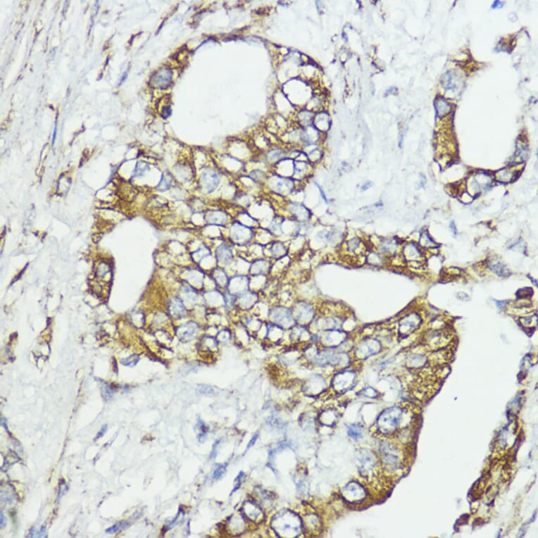 Immunohistochemistry - Anti-SOCS6 Antibody (A12430) - Antibodies.com