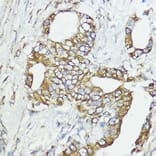 Immunohistochemistry - Anti-SOCS6 Antibody (A12430) - Antibodies.com