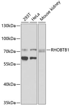 Western blot analysis of extracts of various cell lines, using Anti-RHOBTB1 Antibody (A9959) at 1:1,000 dilution.
Secondary antibody: Goat Anti-Rabbit IgG (H+L) (HRP) (AS014) at 1:10,000 dilution.
Lysates / proteins: 25µg per lane.
Blocking buffer: 3% non-fat dry milk in TBST.
Detection: ECL Basic Kit (RM00020).
Exposure time: 10s.