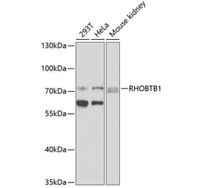 Western Blot - Anti-RHOBTB1 Antibody (A12431) - Antibodies.com