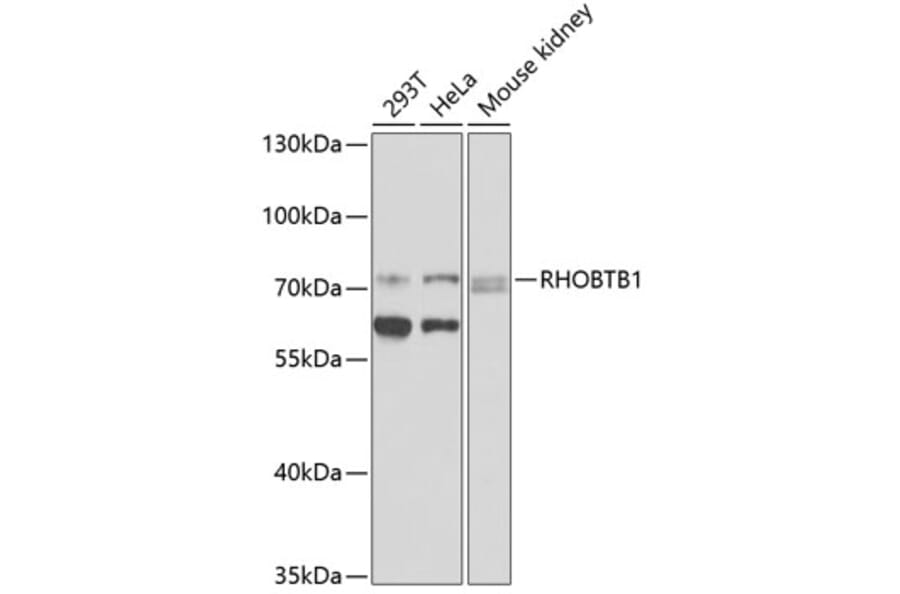 Western Blot - Anti-RHOBTB1 Antibody (A12431) - Antibodies.com
