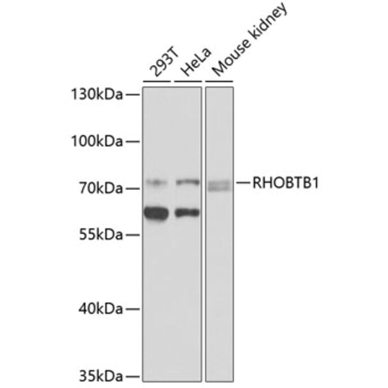 Western Blot - Anti-RHOBTB1 Antibody (A12431) - Antibodies.com