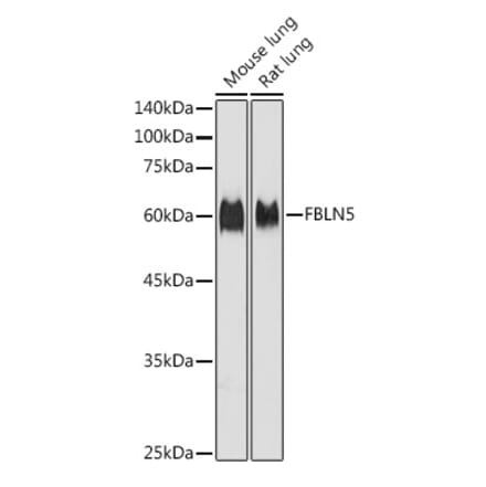 Western Blot - Anti-Fibulin 5 Antibody (A12432) - Antibodies.com