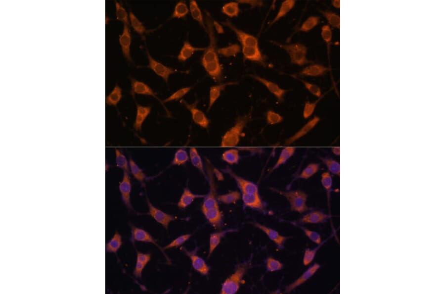 Immunofluorescence - Anti-Fibulin 5 Antibody (A12432) - Antibodies.com