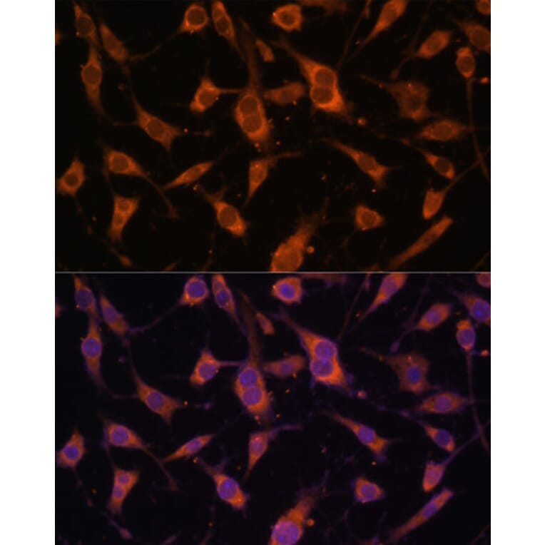 Immunofluorescence - Anti-Fibulin 5 Antibody (A12432) - Antibodies.com