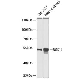 Western Blot - Anti-RGS14 Antibody (A12433) - Antibodies.com