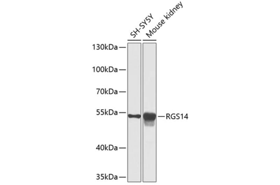 Western Blot - Anti-RGS14 Antibody (A12433) - Antibodies.com