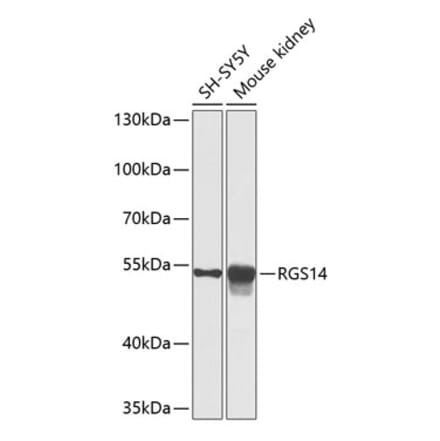 Western Blot - Anti-RGS14 Antibody (A12433) - Antibodies.com