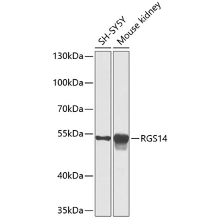 Western Blot - Anti-RGS14 Antibody (A12433) - Antibodies.com