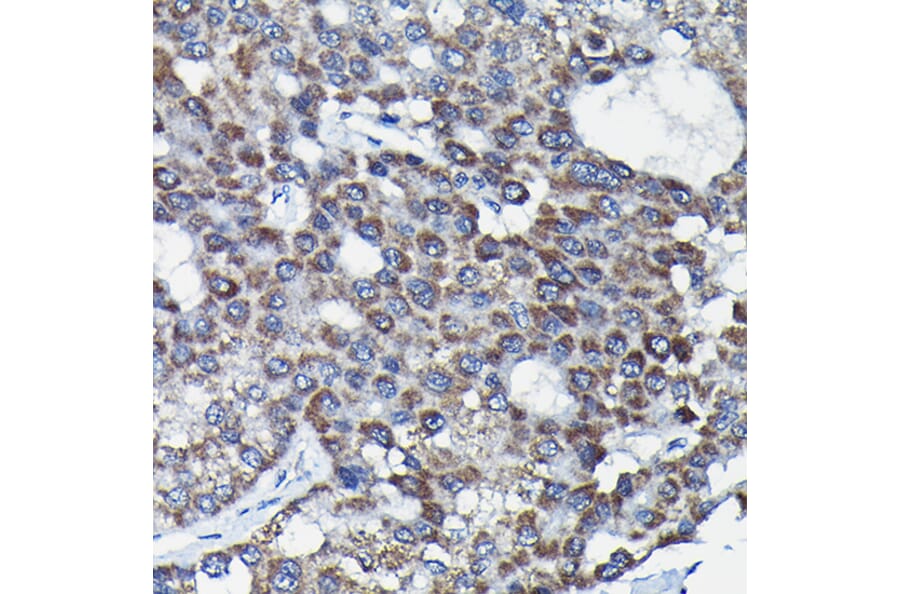 Immunohistochemistry - Anti-RGS14 Antibody (A12433) - Antibodies.com