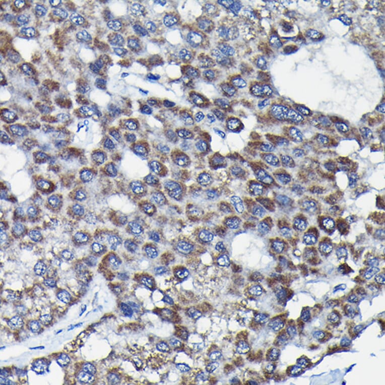 Immunohistochemistry - Anti-RGS14 Antibody (A12433) - Antibodies.com