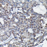 Immunohistochemistry - Anti-RGS14 Antibody (A12433) - Antibodies.com