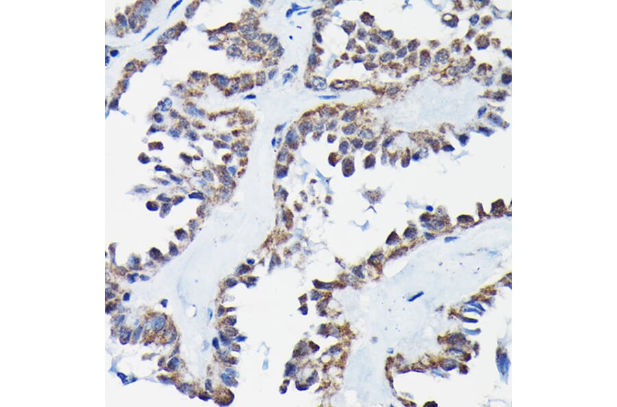 Immunohistochemistry - Anti-RGS14 Antibody (A12433) - Antibodies.com