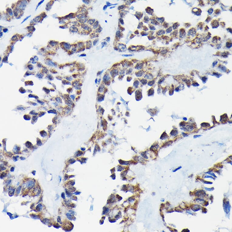 Immunohistochemistry - Anti-RGS14 Antibody (A12433) - Antibodies.com